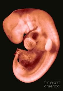 Fig 3. Menselijk embryo van ruim 4 weken oud